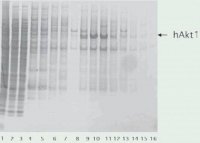 cOmplete, EDTA-free Protease Inhibitor Cocktail 