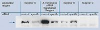 X-tremeGENE siRNA Transfection Reagent 