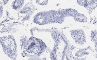 Anti- Tubulin Antibody, clone 10G11 ZooMAb Rabbit Monoclonal 