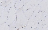 Anti--Dystroglycan Antibody, clone VIA4-1 ZooMAb Mouse Monoclonal 
