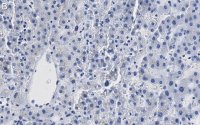 Anti--Glucocerebrosidase Antibody, clone 2I15 ZooMAb Rabbit Monoclonal 