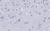 Anti--synuclein Antibody, clone 1D22 ZooMAb Rabbit Monoclonal 