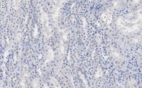 Anti--Tubulin Antibody, clone DM1A ZooMAb Mouse Monoclonal 