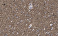 Anti--Tubulin III Antibody, clone 5H16, ZooMAb Rabbit Monoclonal 