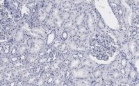 Anti-53BP1 Antibody, clone 1H16 ZooMAb Rabbit Monoclonal 