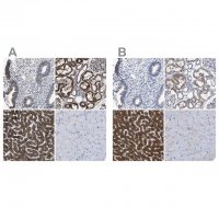 Anti-AASS antibody produced in rabbit 