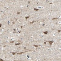 Anti-AATK antibody produced in rabbit 