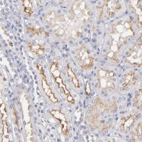 Anti-ABCB1 antibody produced in rabbit 