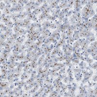 Anti-ABCB11 antibody produced in rabbit 