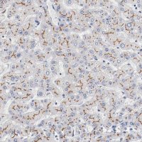 Anti-ABCC2 antibody produced in rabbit 