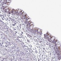 Anti-ABHD17A antibody produced in rabbit HPA047226-100UL
