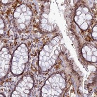 Anti-ABHD17A antibody produced in rabbit HPA043270-100UL
