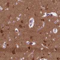 Anti-ABI2 antibody produced in rabbit 