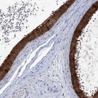 Anti-ABRACL antibody produced in rabbit 