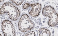Anti-Ac--Tubulin (Lys40) Antibody, clone 1L10, ZooMAb Rabbit Monoclonal 