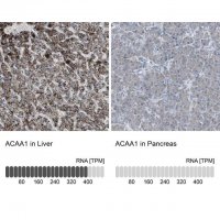 Anti-ACAA1 antibody produced in rabbit 