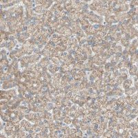 Anti-ACADL antibody produced in rabbit 