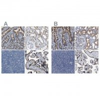 Anti-ACADVL antibody produced in rabbit 
