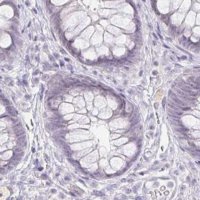 Anti-ACAN antibody produced in rabbit 