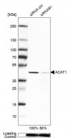 Anti-ACAT1 antibody produced in rabbit 