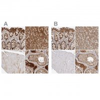 Anti-ACAT2 antibody produced in rabbit HPA025765-100UL