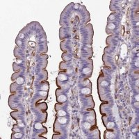 Anti-ACE antibody produced in rabbit HPA029298-100UL