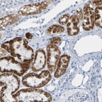 Anti-ACMSD antibody produced in rabbit 