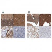 Anti-ACOT7 antibody produced in rabbit HPA025735-100UL