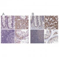 Anti-ACOX2 antibody produced in rabbit 