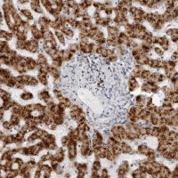 Anti-ACP6 antibody produced in rabbit 