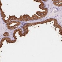 Anti-ACPP antibody produced in rabbit HPA063916-100UL