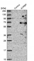 Anti-ACRBP antibody produced in rabbit HPA039081-100UL