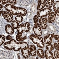 Anti-ACSF2 antibody produced in rabbit 