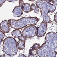 Anti-ACSS1 antibody produced in rabbit 