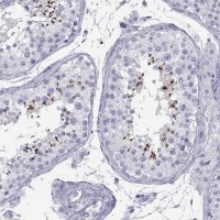 Anti-ACTL7A antibody produced in rabbit 