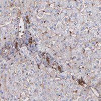 Anti-ACTN4 antibody produced in rabbit 