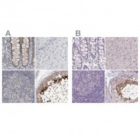 Anti-ACTRT2 antibody produced in rabbit 