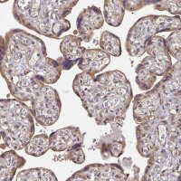 Anti-ACVR2B antibody produced in rabbit 