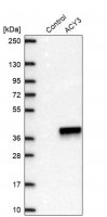 Anti-ACY3 antibody produced in rabbit 
