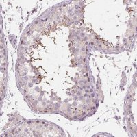 Anti-ADAM20 antibody produced in rabbit 