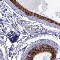 Anti-ADAM28 antibody produced in rabbit 