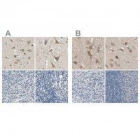 Anti-ADAP1 antibody produced in rabbit 