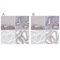 Anti-ADAR antibody produced in rabbit 