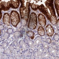 Anti-ADH7 antibody produced in rabbit 