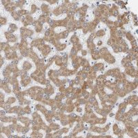 Anti-ADHFE1 antibody produced in rabbit 