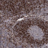 Anti-ADK antibody produced in rabbit 