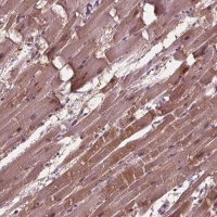 Anti-ADPRHL1 antibody produced in rabbit HPA066478-100UL