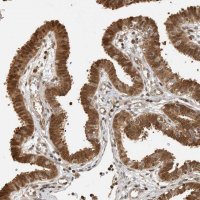 Anti-ADPRHL2 antibody produced in rabbit 