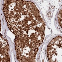 Anti-ADRM1 antibody produced in rabbit 