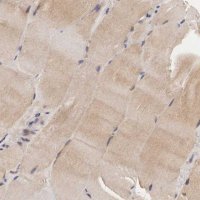 Anti-ADSL antibody produced in rabbit 
